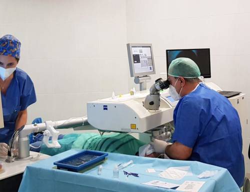 Laser eye surgery in Marbella