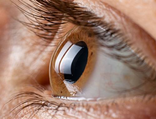 Astigmatism correction in Marbella