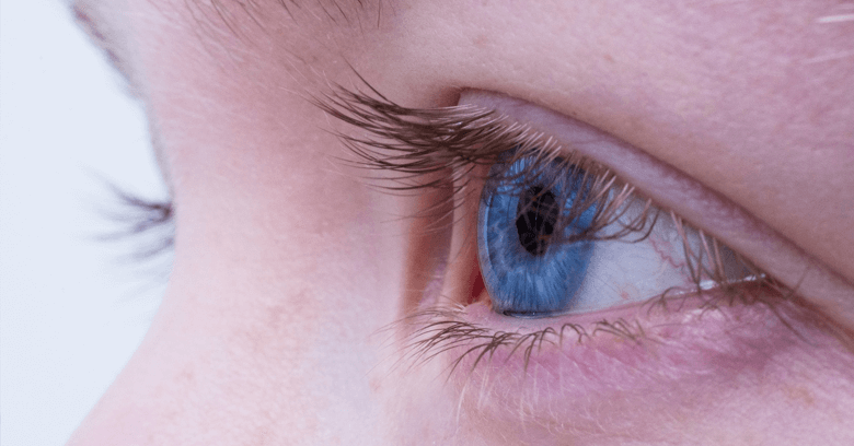 Como Quitar Un Derrame En El Ojo Por Golpe Consejos Ojos