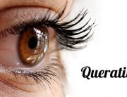 Queratitis Causas Y Tratamiento