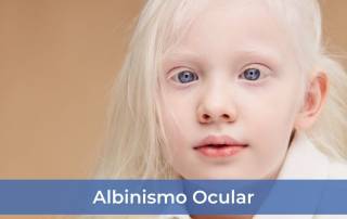 albinismo ocular